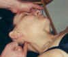 Occiput.JPG forehead (19657 bytes)